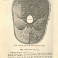 Explanation of the Cuts, in Matrimony: Or Phrenology and Physiology Applied to the Selection of Congenial Companions for Life...