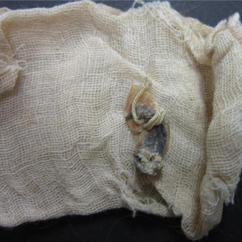 Preserved umbilical cord